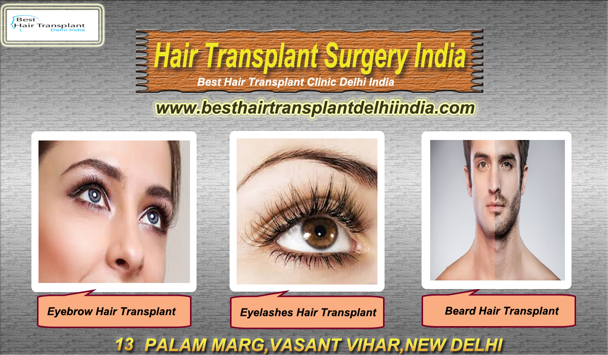 Eyebrow Transplant Cost In Delhi Face Surgery Delhi