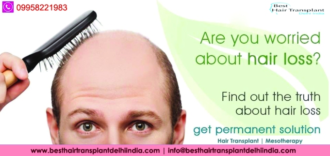 hair transplant clinic in south delhi, mesotherapy for hair loss cost in delhi, hair restoration treatment, best hair transplant surgeon in delhi, hair transplant surgery, hair loss treatment