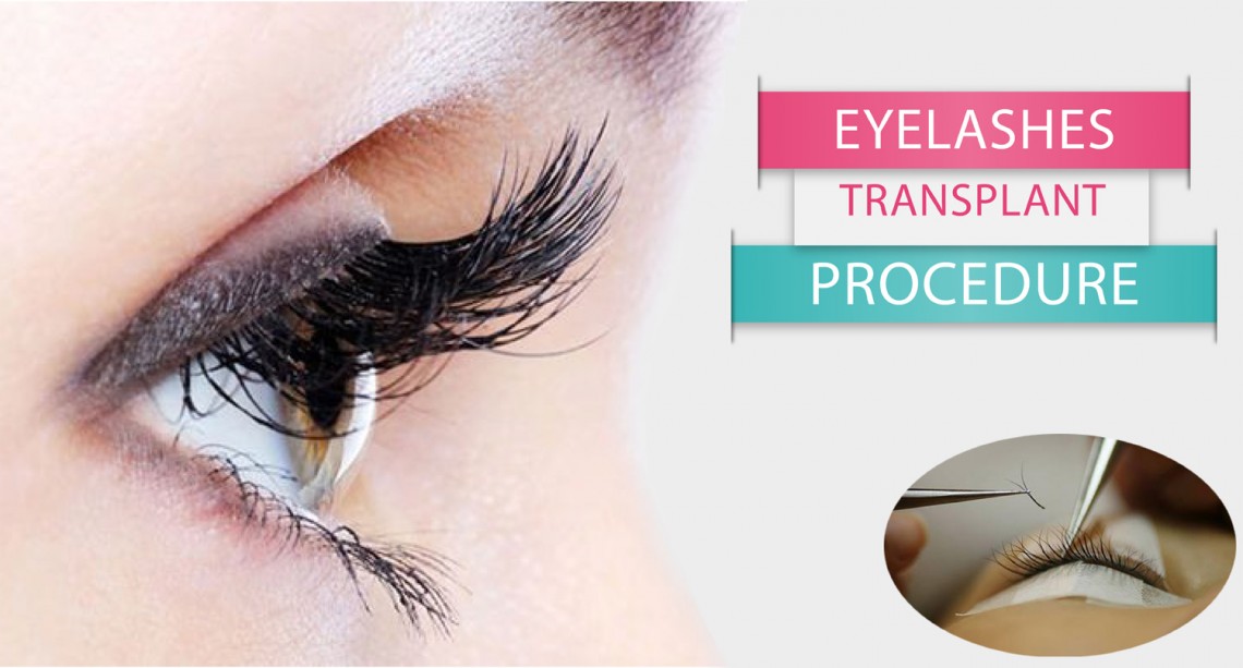 #EyelashHairTransplants, #EyelashTransplantSurgeon, #Men, #Women, #HairTransplantCost, #Delhi, #India